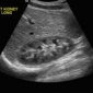 Ultrasound